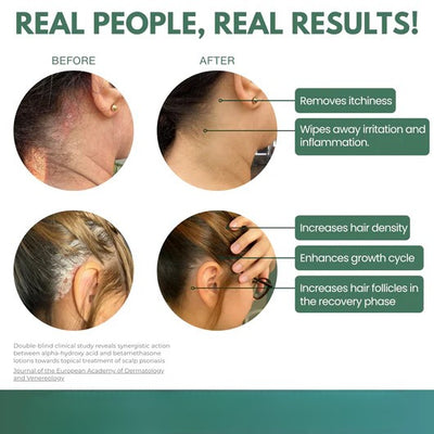 Scalp Renewal Elixir