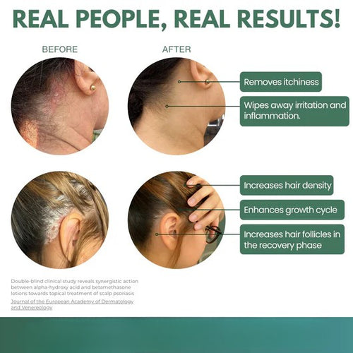 Scalp Renewal Elixir