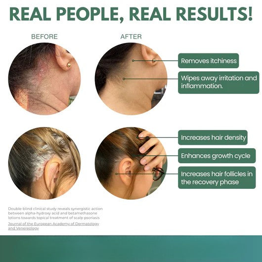 Scalp Renewal Elixir