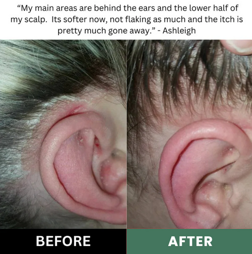 Scalp Renewal Elixir