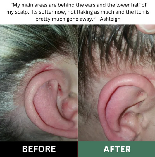 Scalp Renewal Elixir