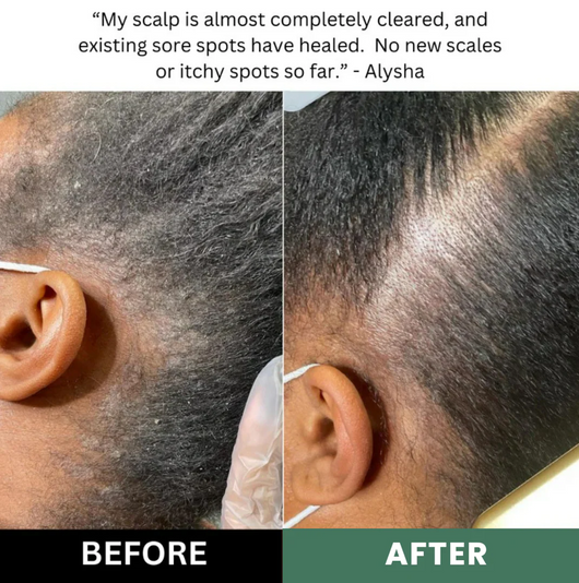 Scalp Renewal Elixir